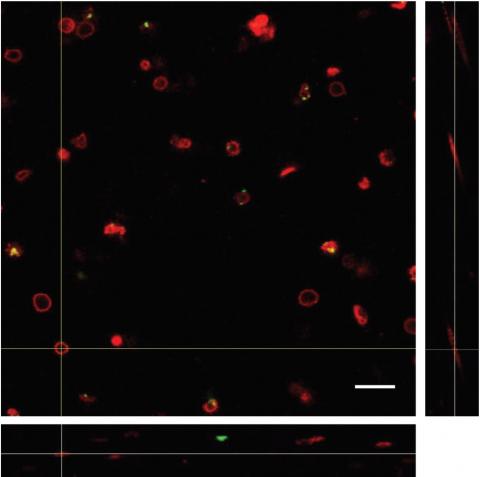 Red blood cell interaction with nanoparticles orthogonal view