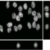 HL60 cells