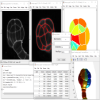 Processing of a 3D image with the ImageM sotfware