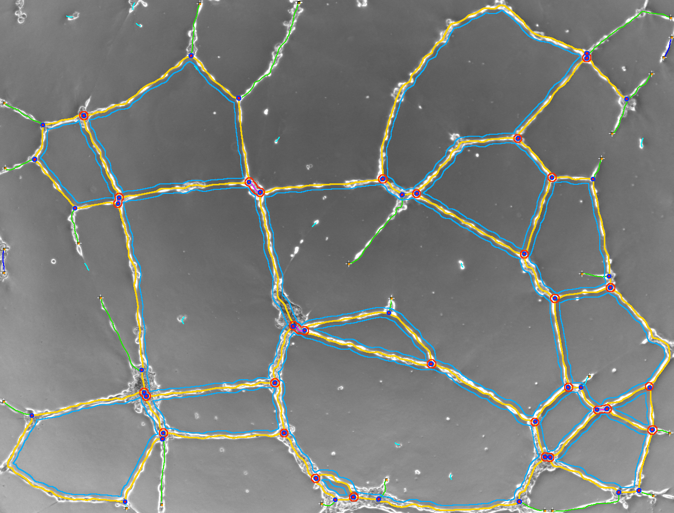 Angiogenesis Analyzer For Imagej Bise