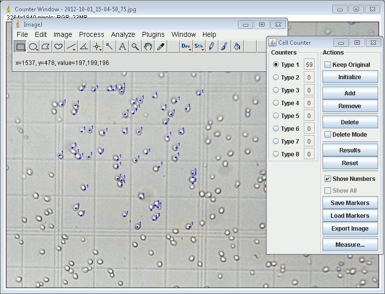 cell counter imagej fiji