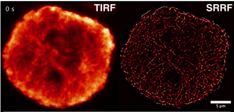 Comparison TIRF - SRRF