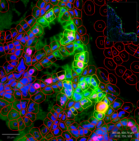 cells positive for different markers in different channels