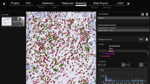 HistoMetriX for image analysis of histology slides